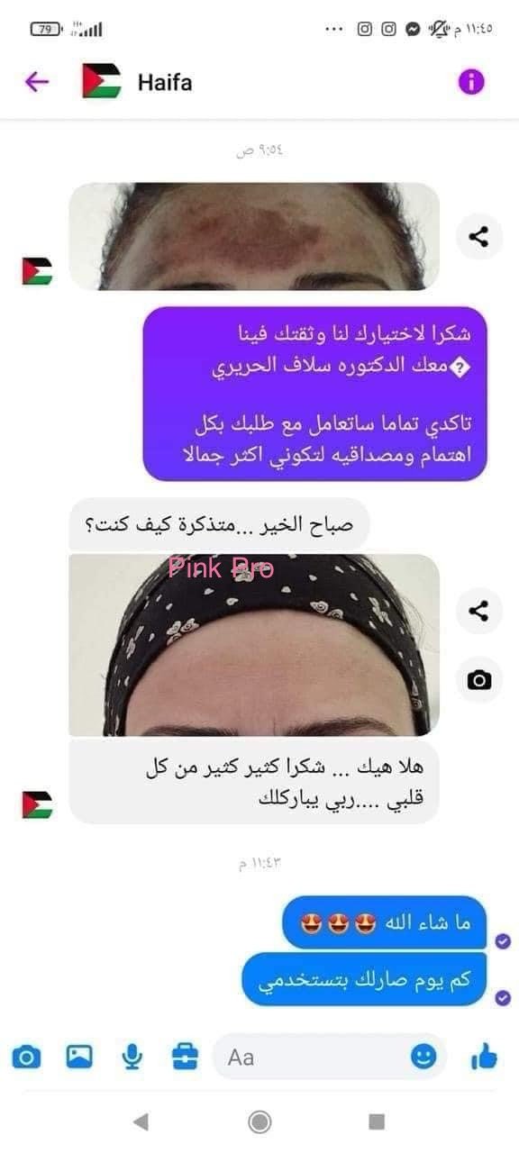 راي زبونه